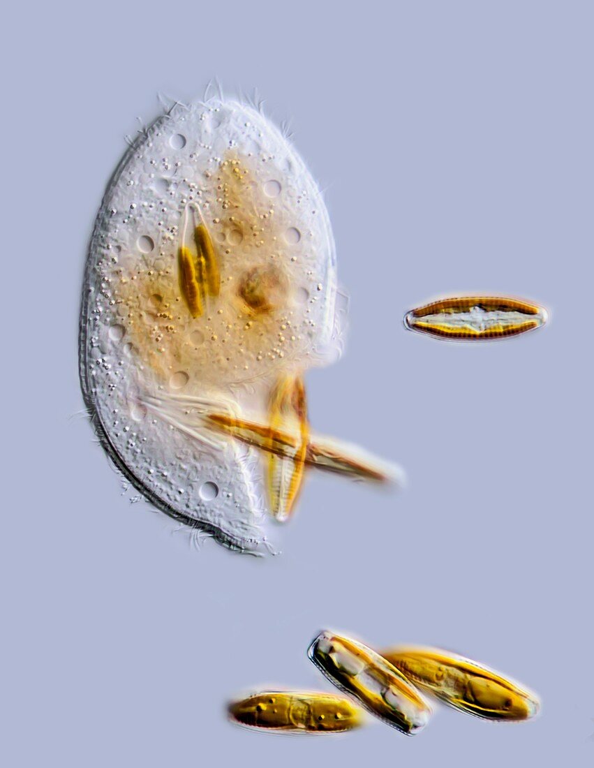 Trithigmostoma ciliate,LM