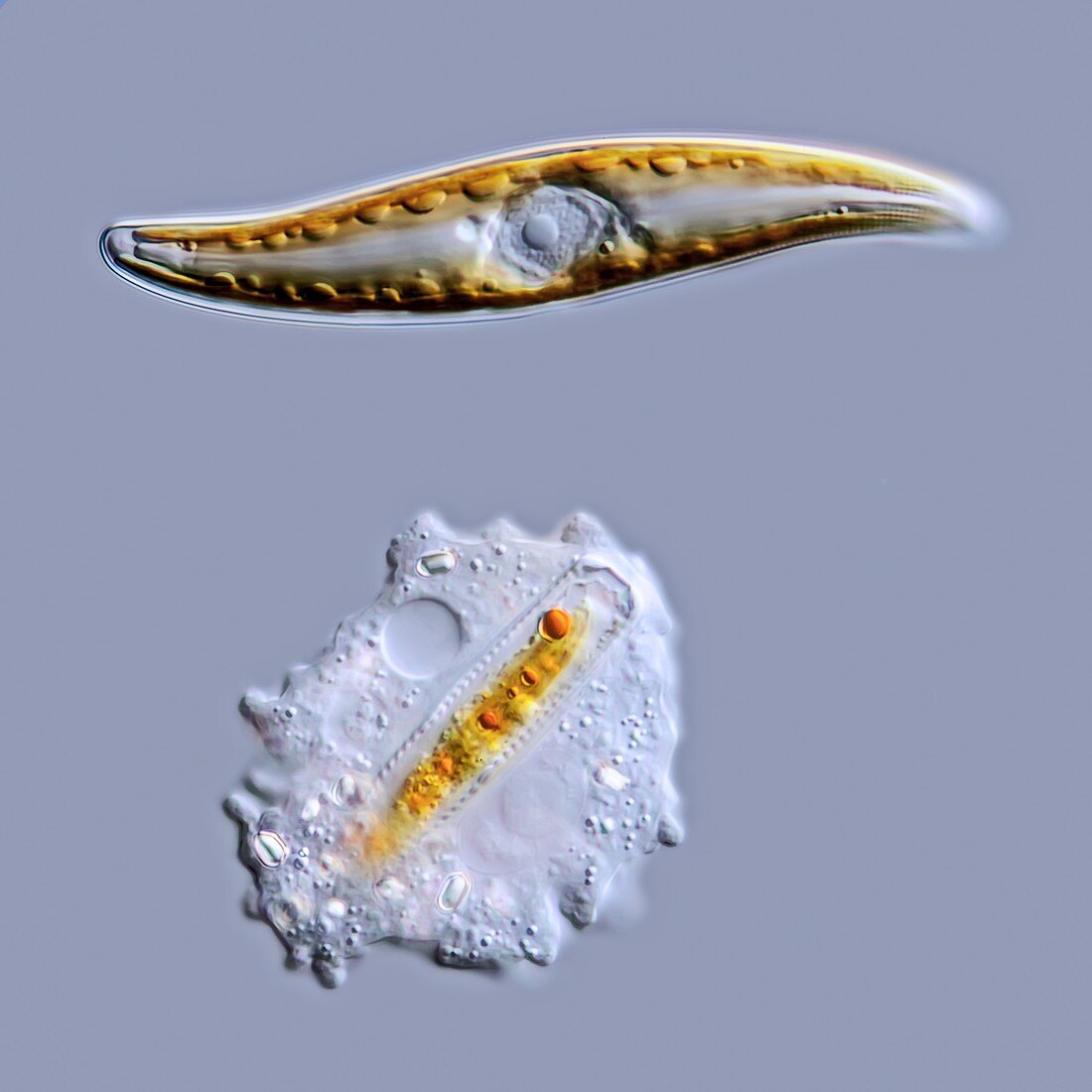 Gyrosigma diatom,Mayorella amoeba,LM