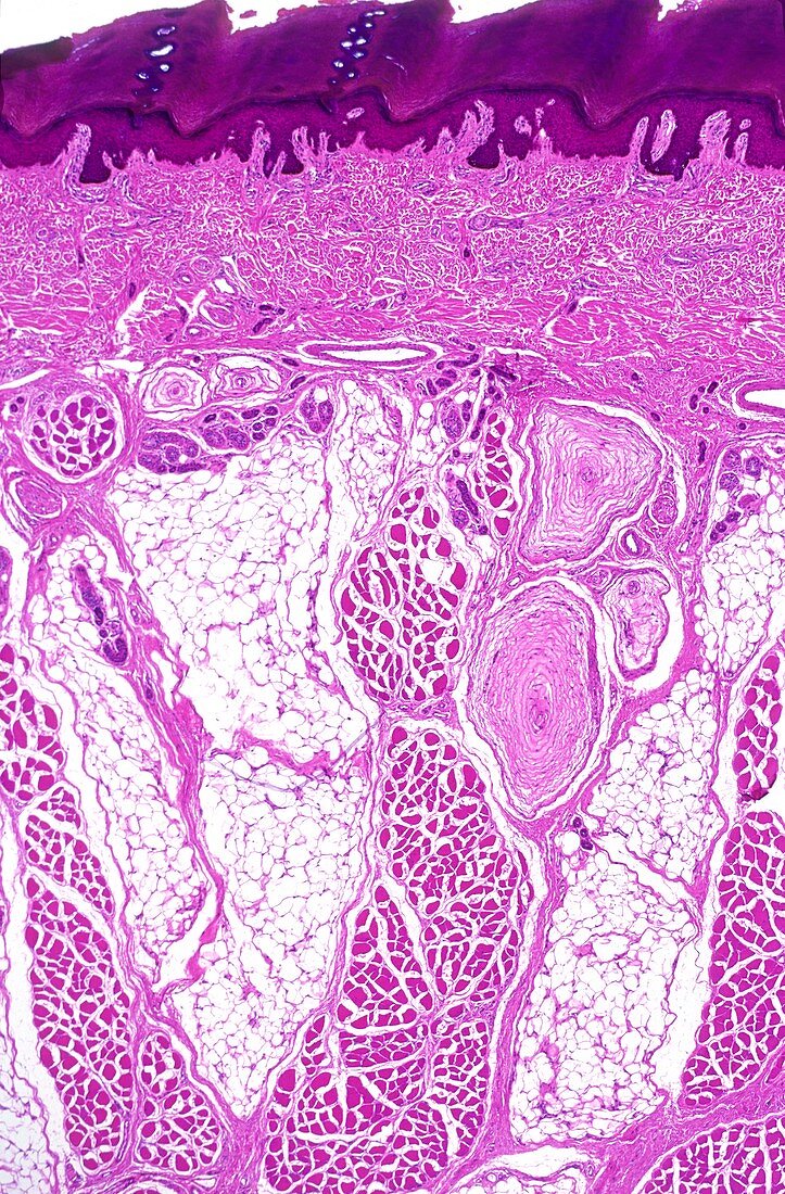Pacinian receptors in skin,light microgr