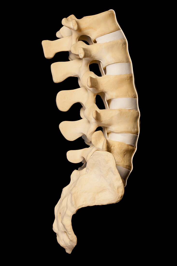 3D printed anatomical lower spine model