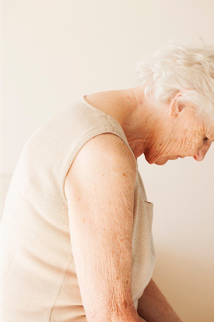 Elderly woman with bent posture