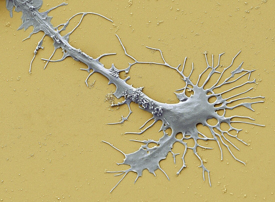 Stem cell-derived neuron growth cone,SEM