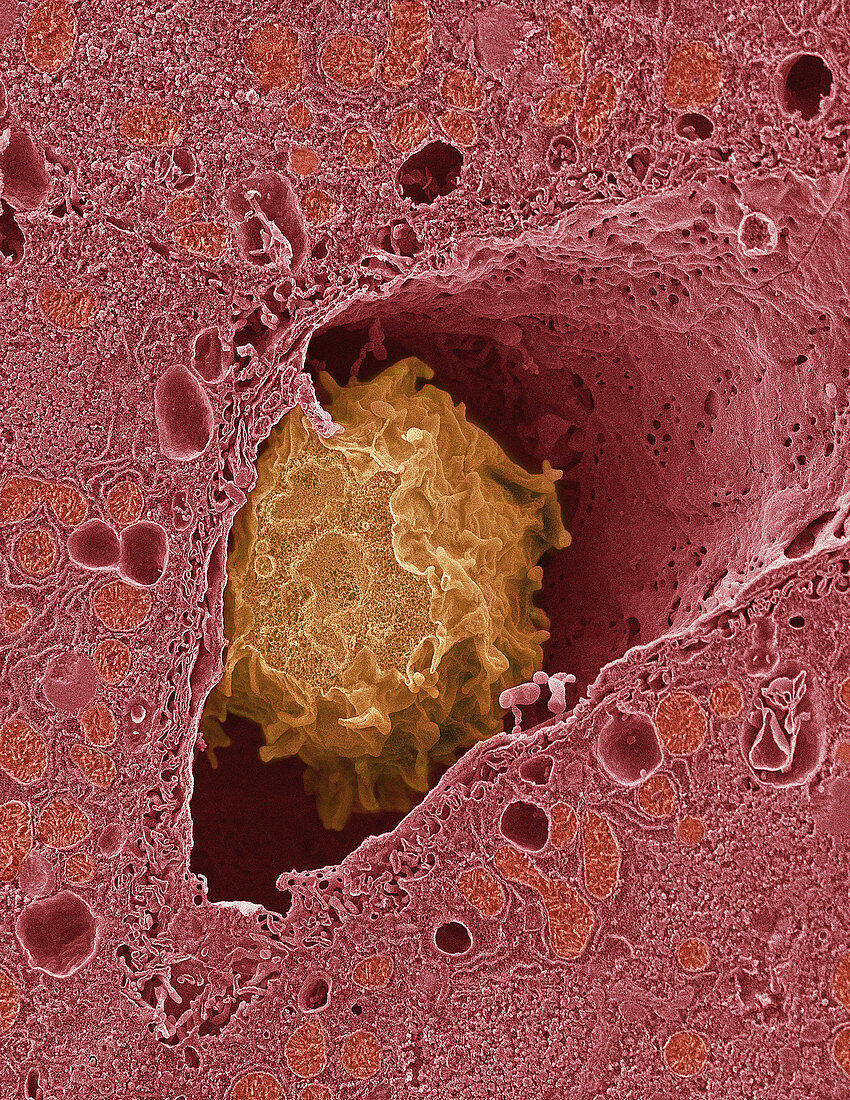 Liver macrophage cell,SEM