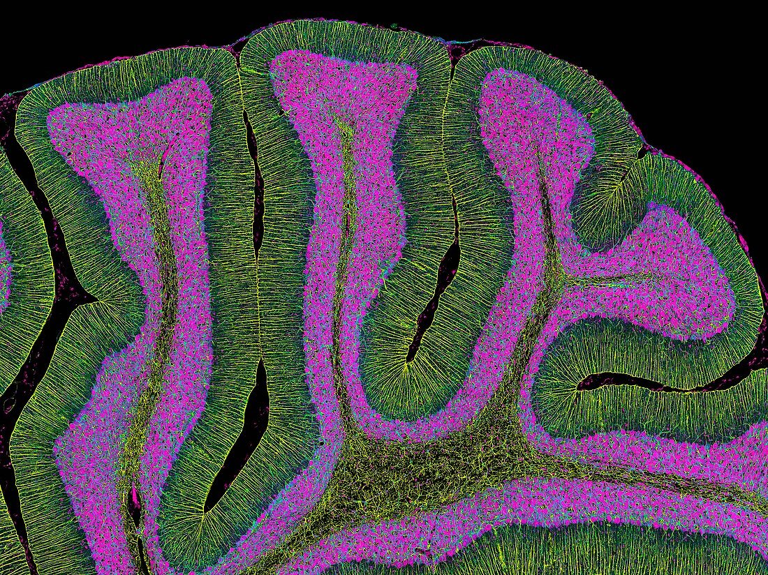 Cerebellum from a brain,light micrograph