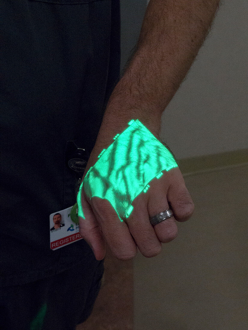 Hand veins shown by infrared finder