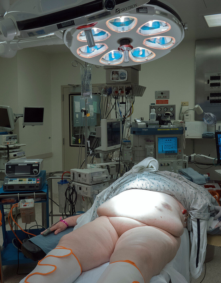 Morbidly obese patient awaiting surgery