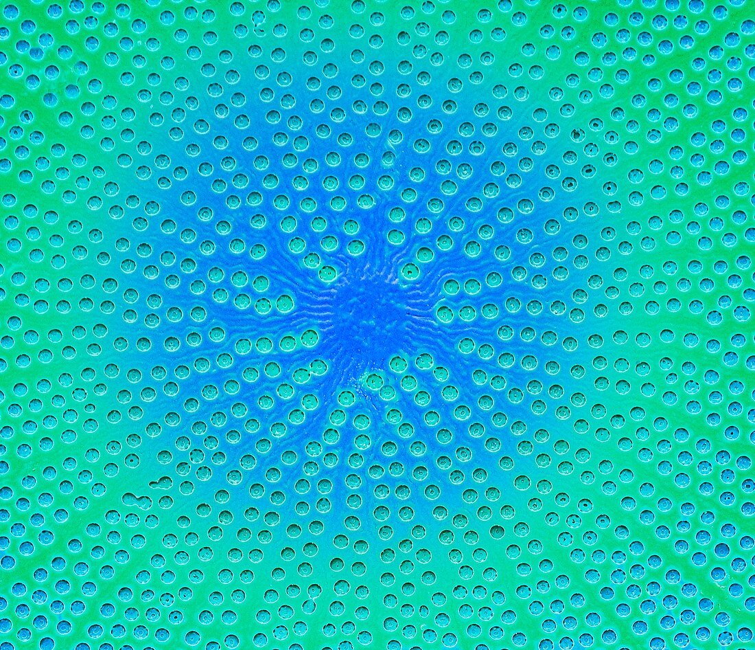 Diatom detail,SEM