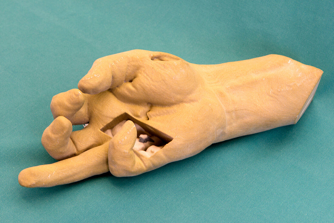 Forensics 3D autopsy reconstruction