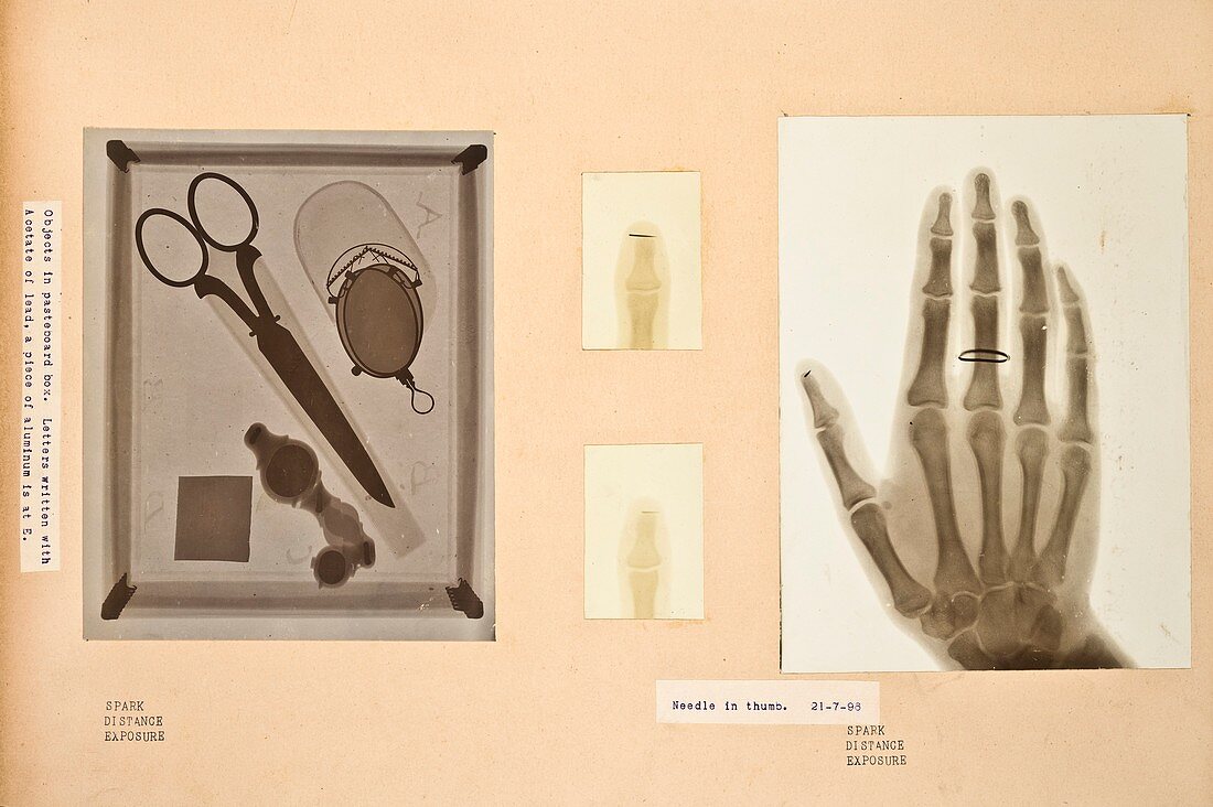 Historical X-rays,early 20th century