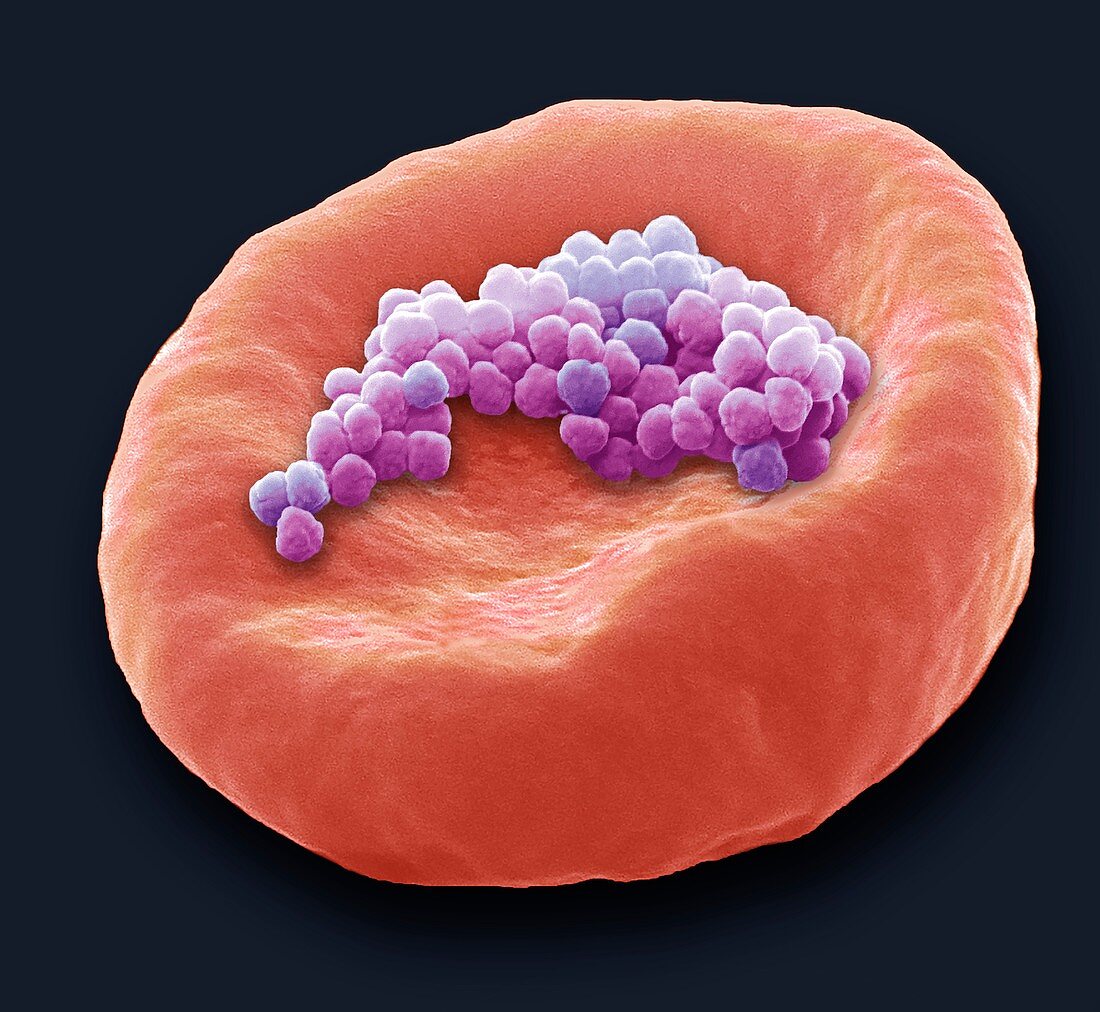 Microbeads on a red blood cell,SEM