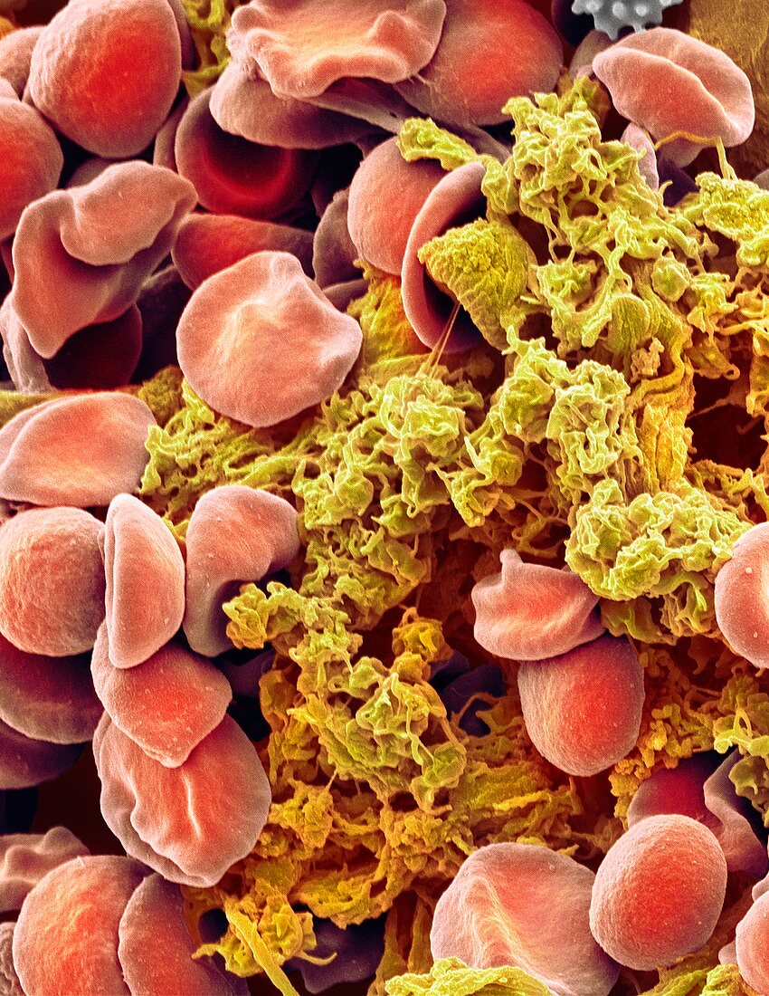 Red blood cells and platelets,SEM