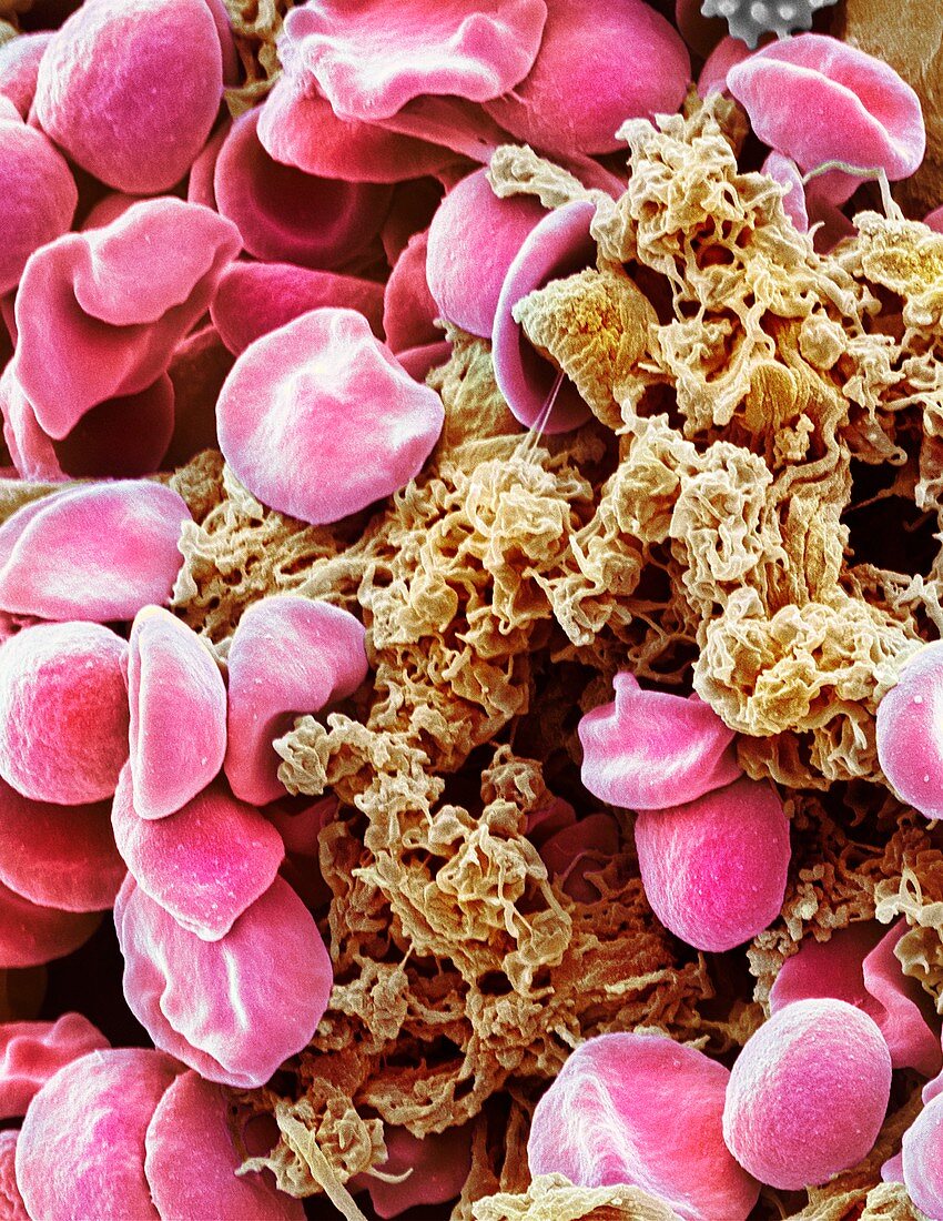 Red blood cells and platelets,SEM