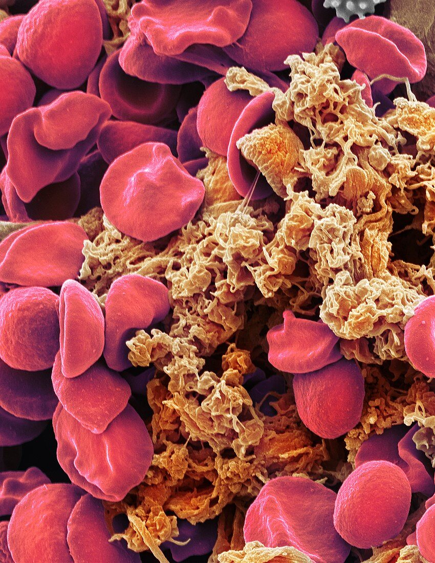 Red blood cells and platelets,SEM