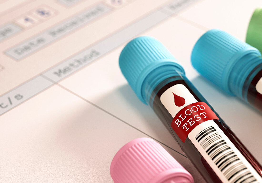 Blood samples for testing in vials