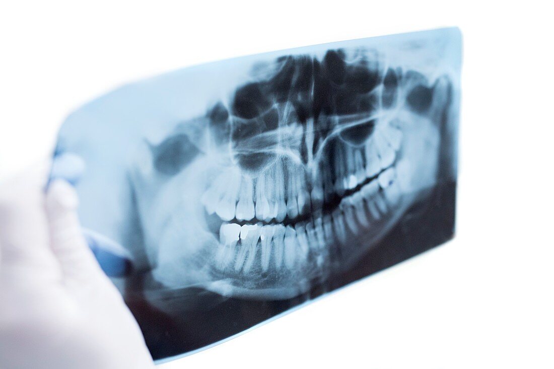 Dentist holding teeth x-ray