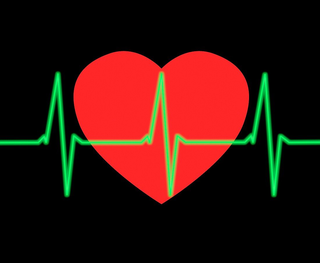 ECG heartbeat trace, conceptual image