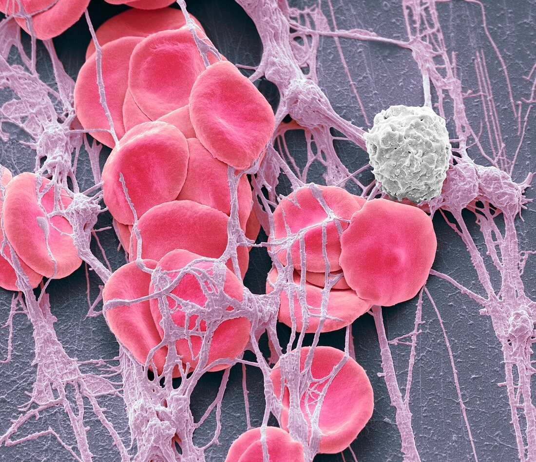 Blood from wound site, SEM