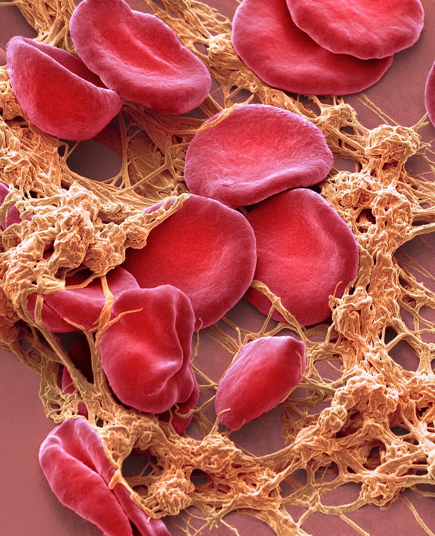 Blood from wound site, SEM