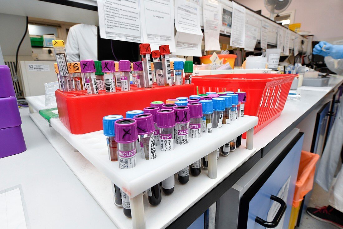 Samples in a pathology laboratory