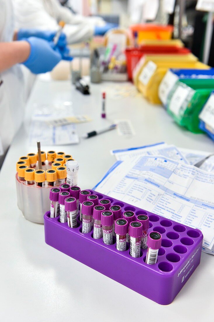 Samples in a pathology laboratory