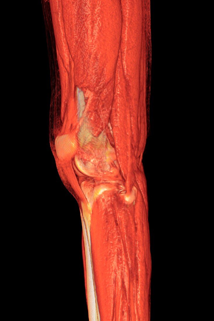 Knee joint and muscles, illustration