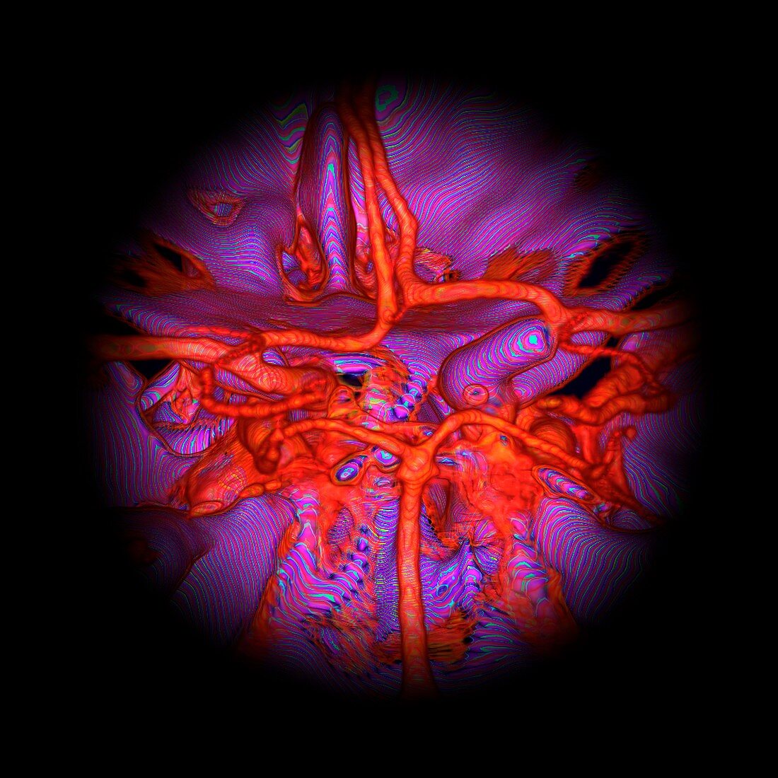 Intracranial arteries, illustration