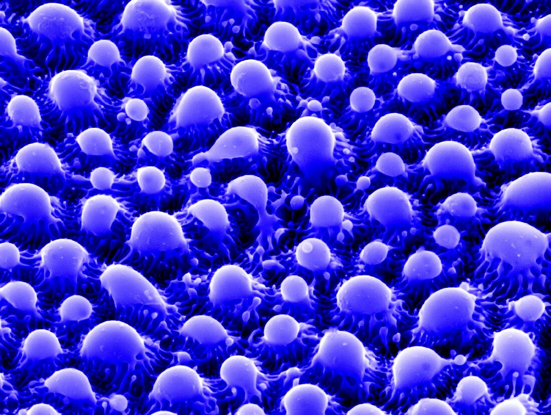 Nanostructures on tantalum, SEM