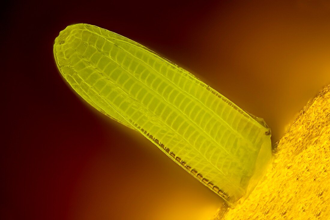 Butterfly egg, fluorescence light micrograph