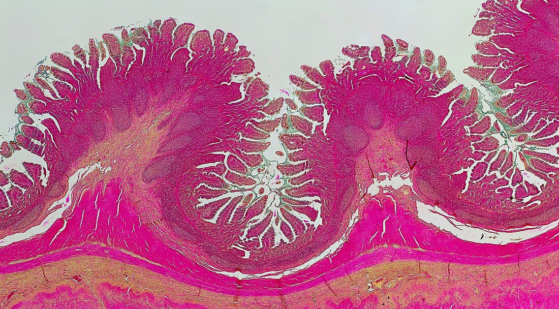 Human small intestine, light micrograph