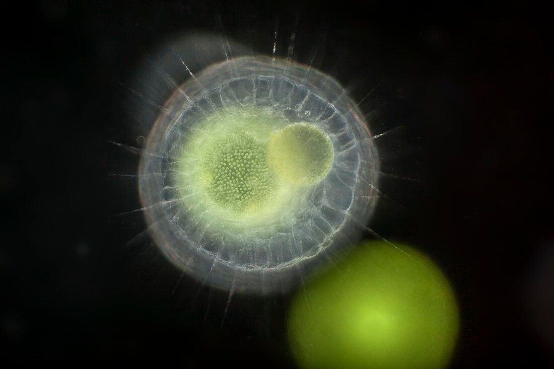 Heliozoa feeding on volvox, light micrograph