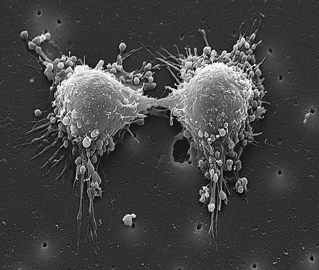 Cancer cell division, SEM