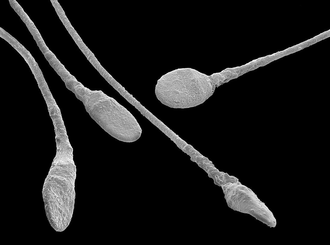 Human sperm cells, SEM