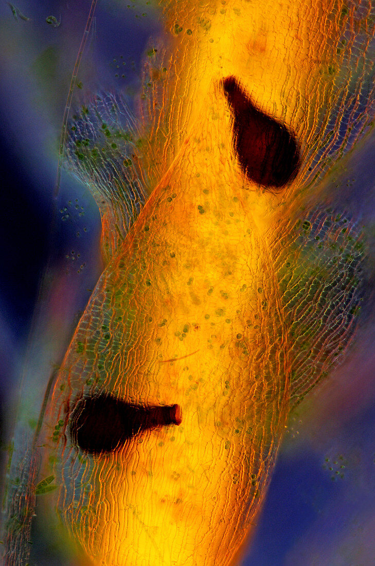 Rotifer on sphagnum moss, light micrograph