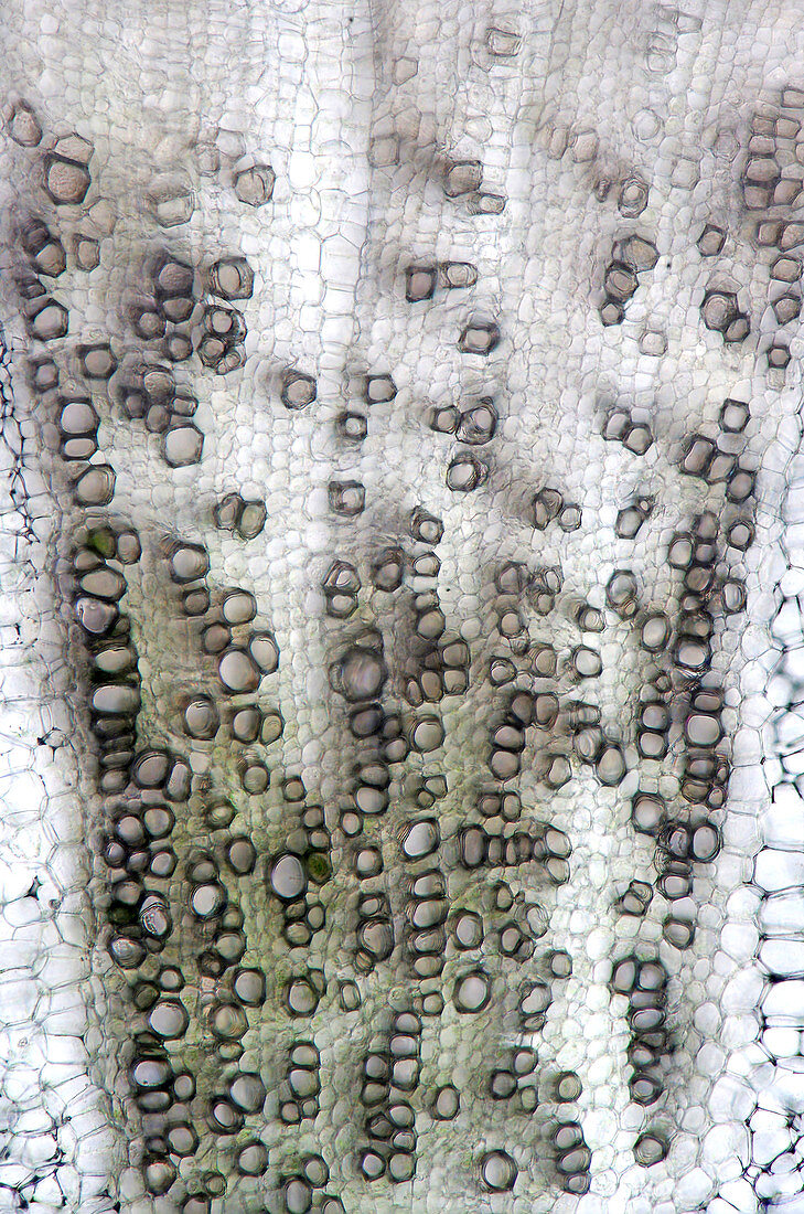 Broccoli (Brassica oleracea) stalk, light micrograph