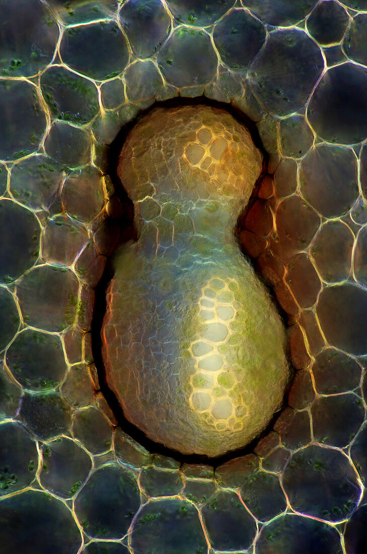 Fern stalk, light micrograph