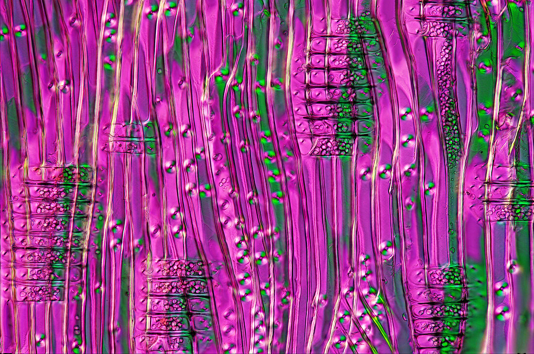 Cypress tree stalk, light micrograph