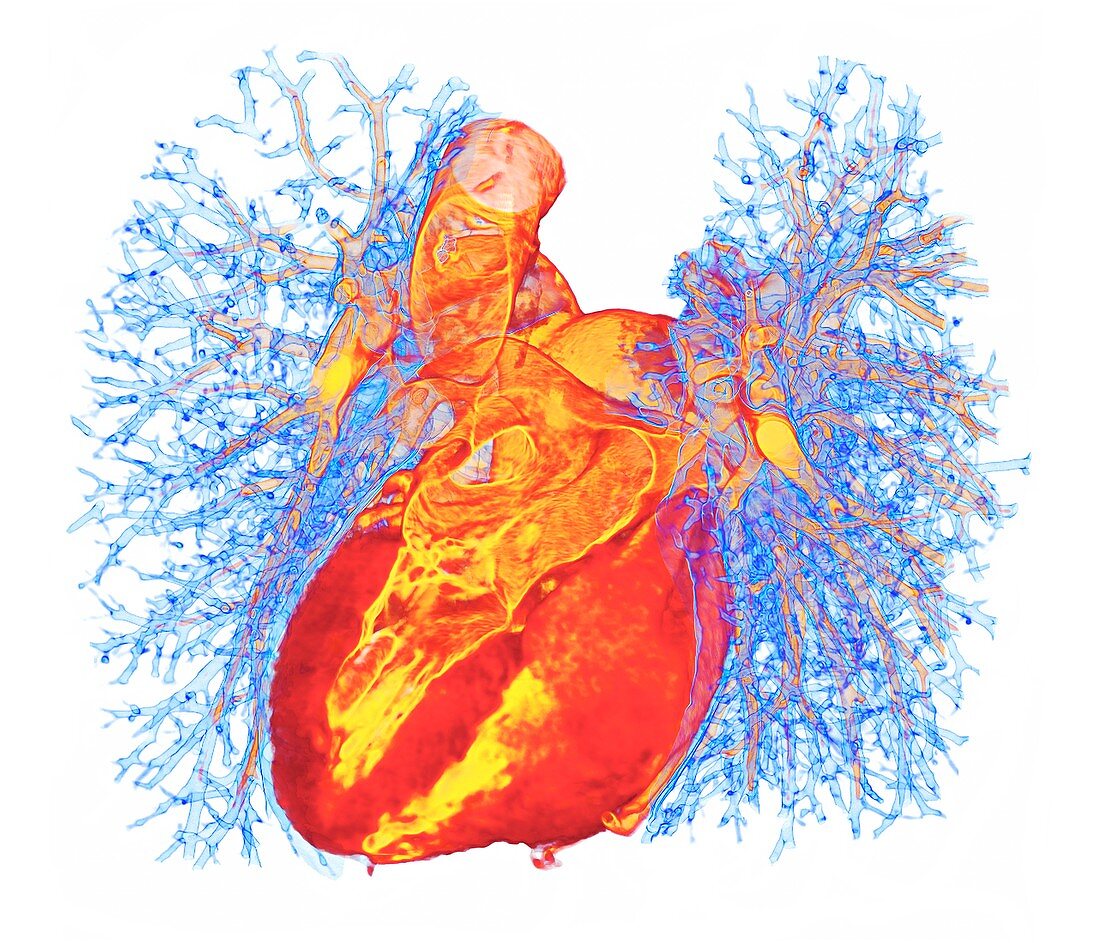Human heart and lung bronchioles, 3D CT scan