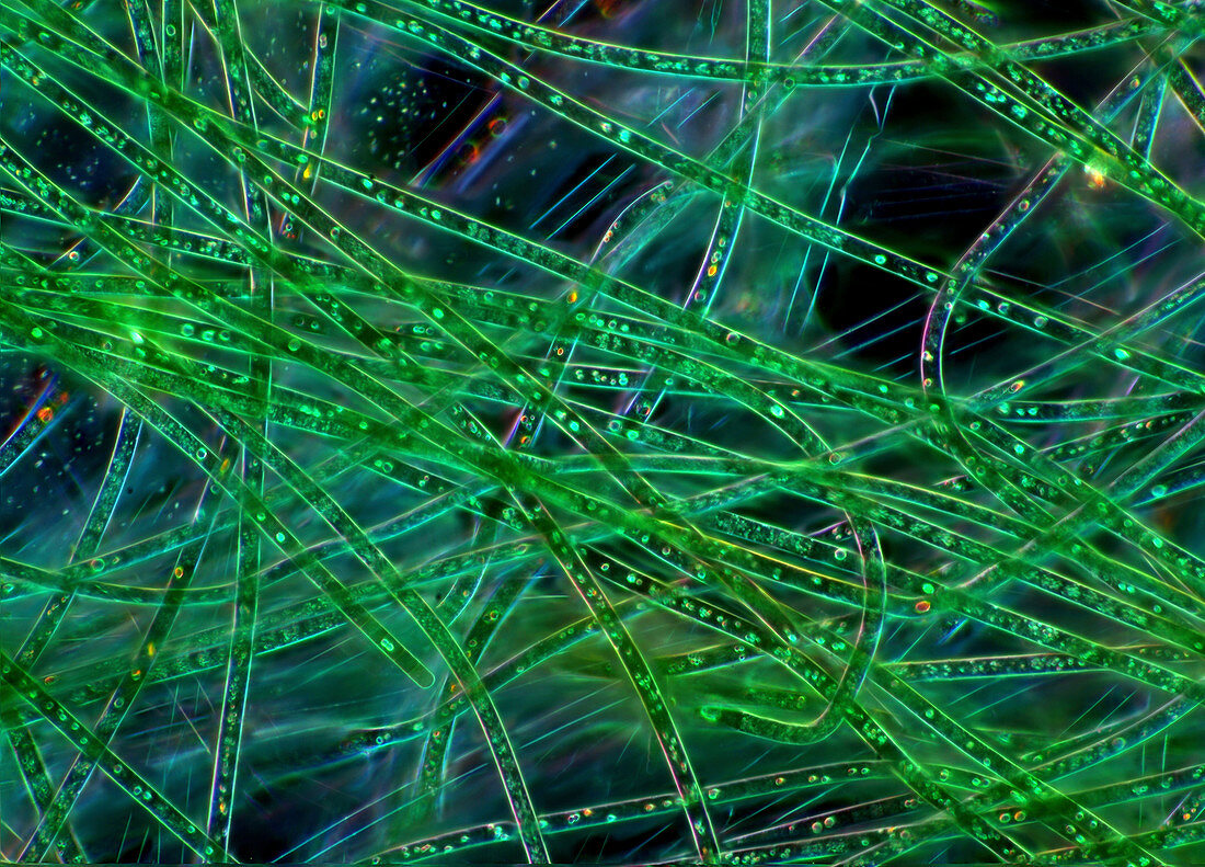 Filamentous green algae, light micrograph