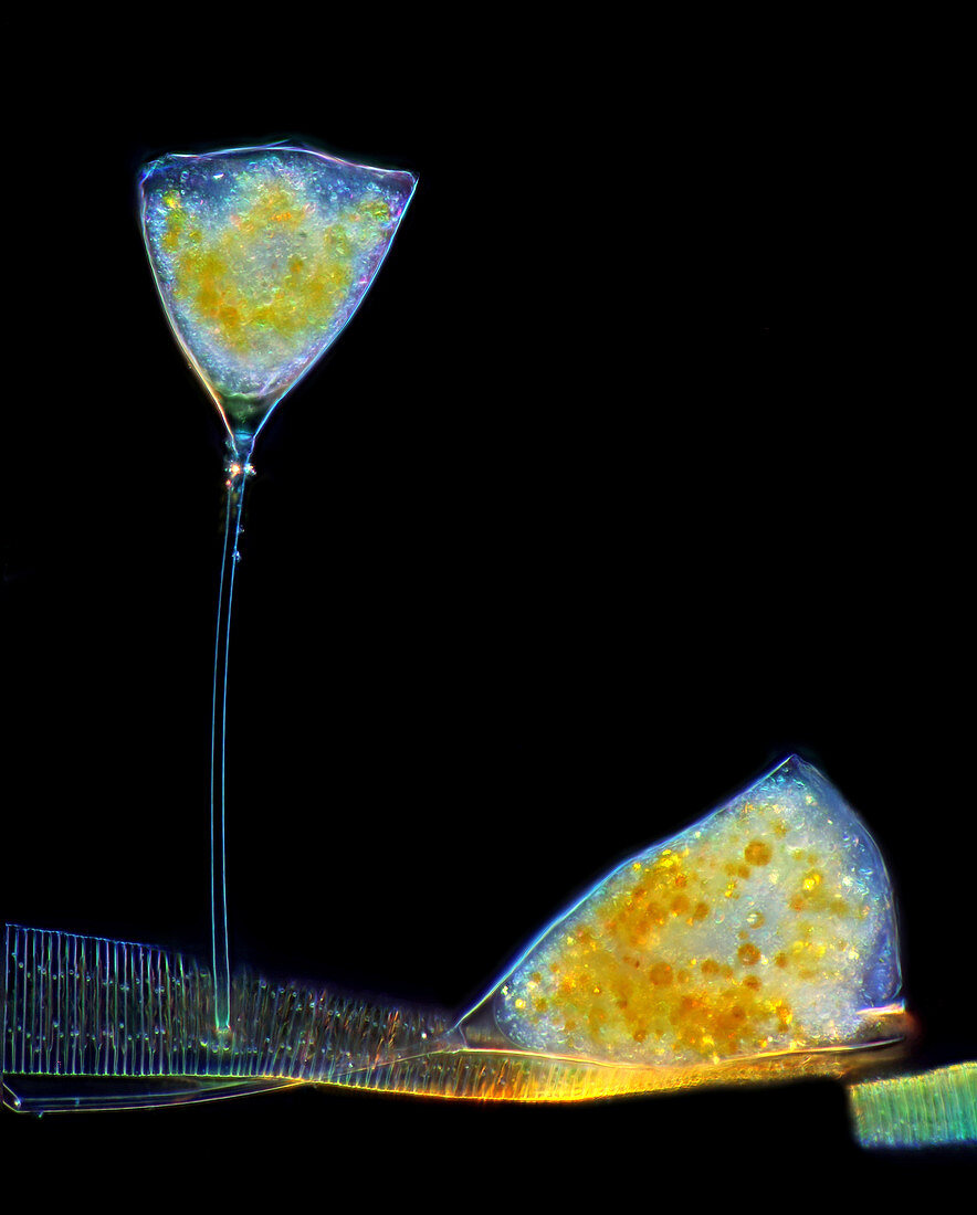 Suctorian protozoa and fragilaria diatoms, light micrograph