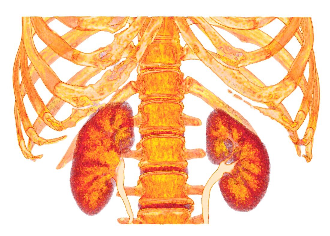 Kidneys and spine and ribs, 3D CT scan