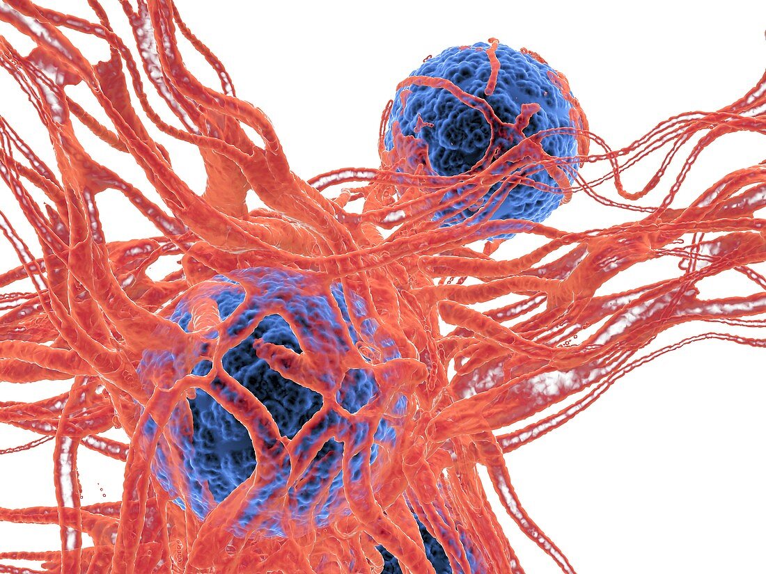 Cancer cell, illustration