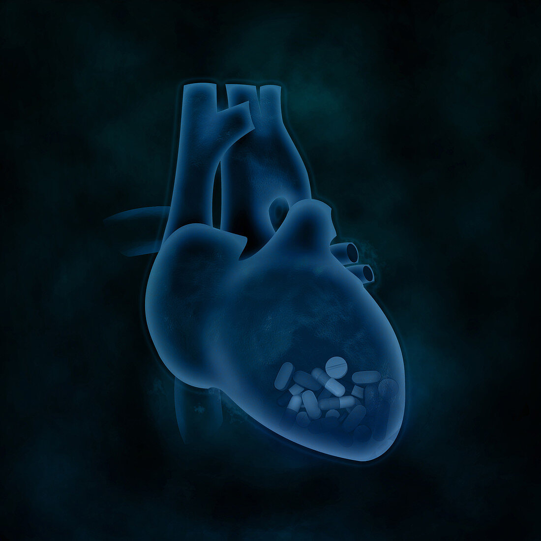 Conceptual illustration of heart issues