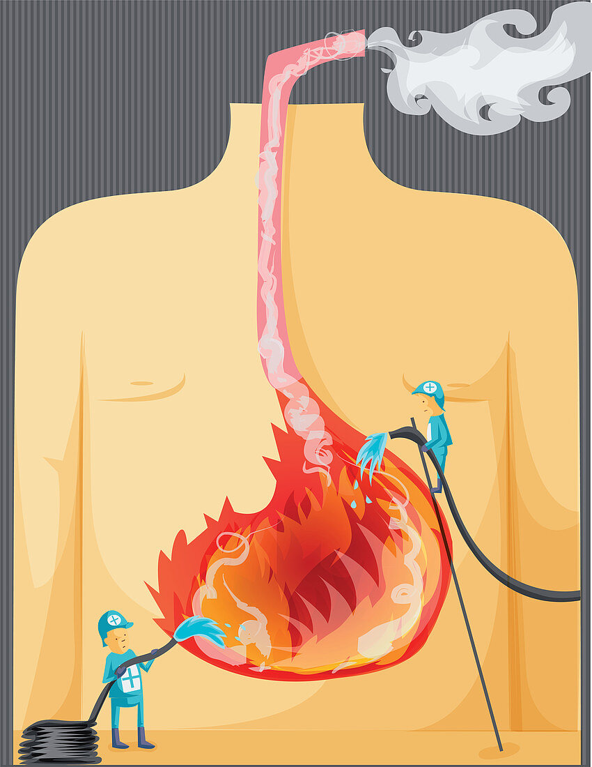 Illustration of indigestion