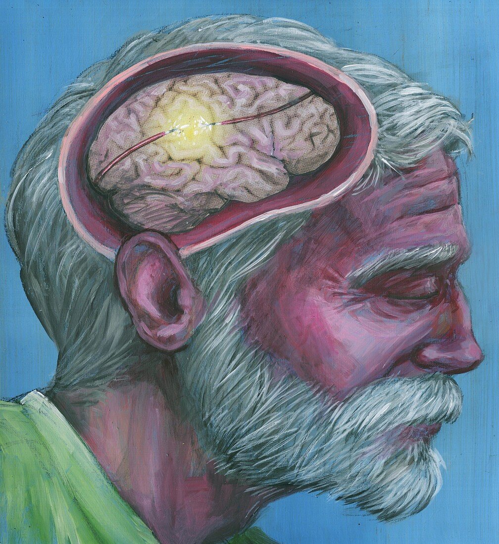 Illustration of senior man with Alzheimer's disease