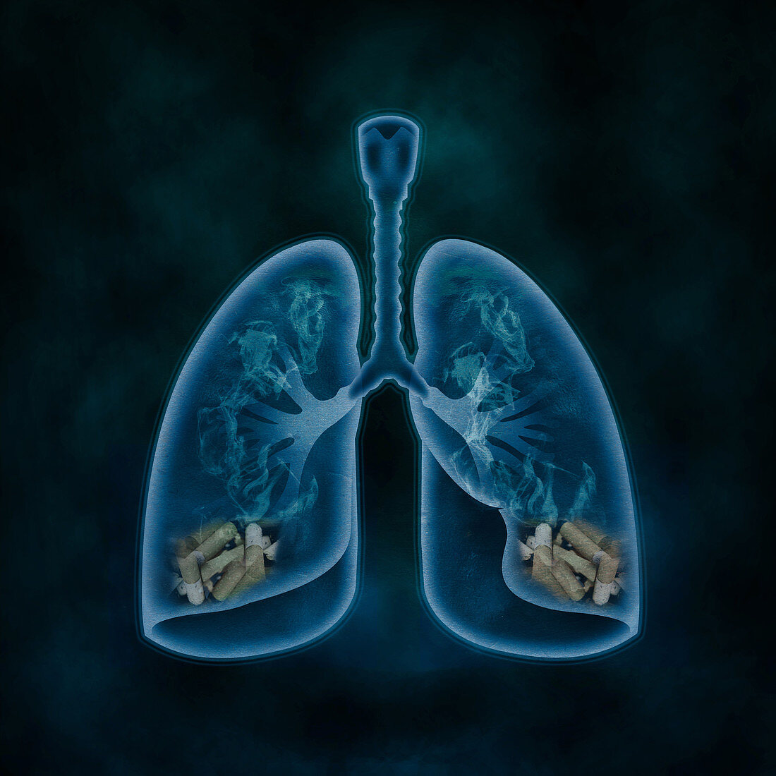Illustration of lungs filled with cigarettes