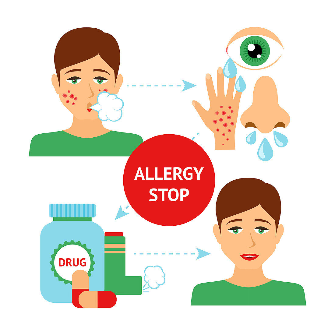 Allergy treatment, illustration