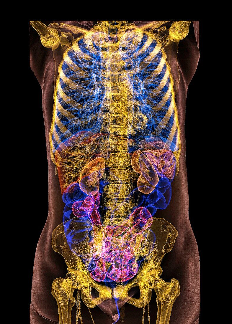 Human internal organs, 3D CT scan