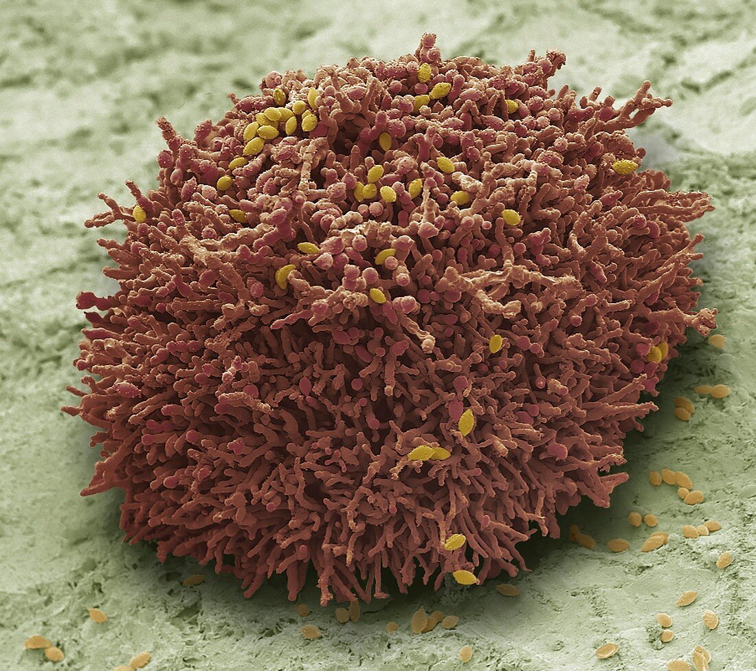 Mould colony, SEM