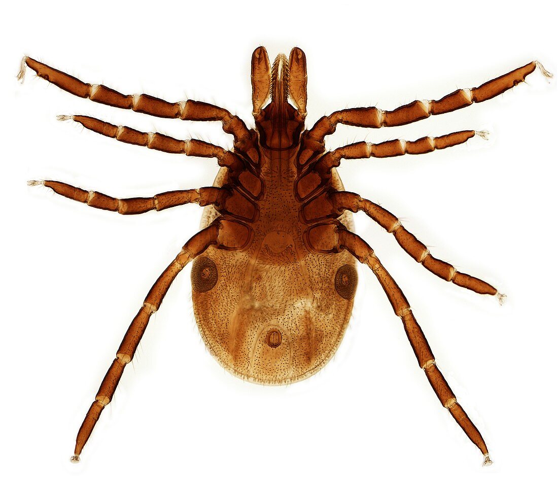 Female Lyme disease tick, light micrograph