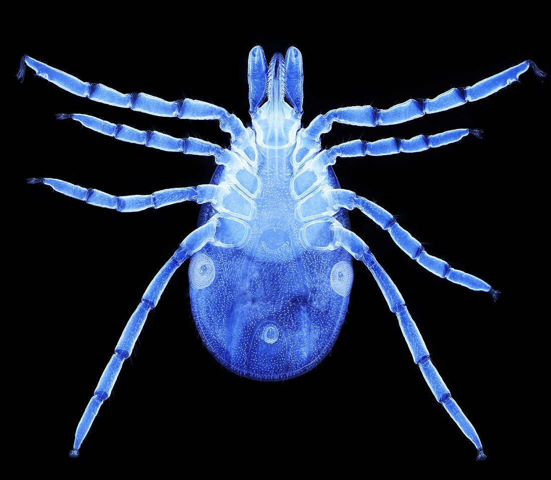 Female lyme disease tick, light micrograph